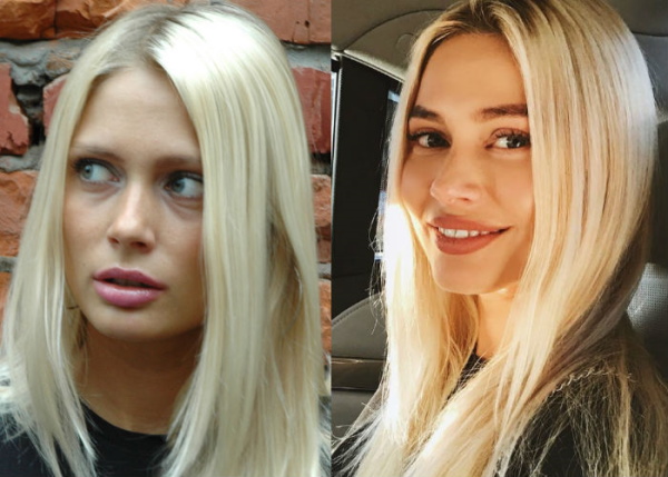 Natalia Rudova avant et après la chirurgie plastique, photos chaudes en maillot de bain, biographie