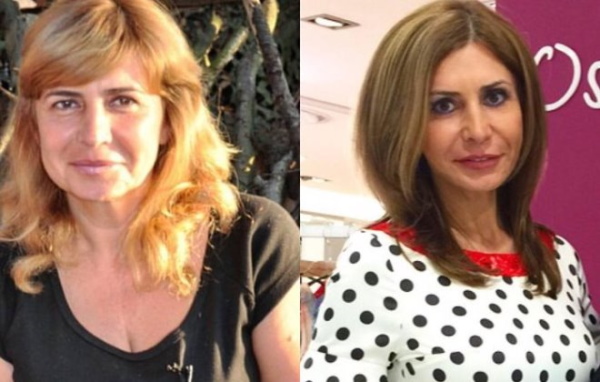 Irina Agibalova. Gambar sebelum dan selepas pembedahan, penurunan berat badan