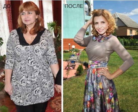 Irina Agibalova. Foto's voor en na de operatie, gewichtsverlies